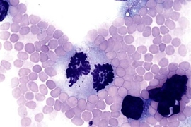A colon cancer cell circulating in the blood stream of an LFS mouse is in the process of dividing and contains substantially more than the normal number chromosomes, a feature that is characteristic of tumor cells. <a onclick="MM_openBrWindow('mousemodel-smear-enlarged.html','','width=509, height=583')">
<span onmouseover="this.className='cursorChange';">
<strong>Open image gallery</strong>
</span...