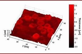 Researchers at MIT's Spectroscopy Laboratory created this image of red blood cells using a technique known as quantitative phase imaging, which allows scientists to view living cells.