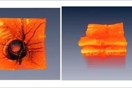 Images of the human optic nerve head. Comparison of surface appearance (left) versus three dimensional optical coherence tomography (OCT) imaging requires extremely fast measurement speeds because 3D data sets are large. 3D OCT data can be processed to visualize the detailed internal structure of the retina. These technologies can detect subtle changes in the retina which indicates early stage dis...