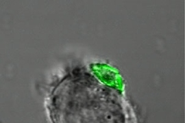 This T cell also has a polymer backpack. The scale bar is 10 micrometers.