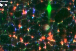 A tri-color X-ray fluorescence map of metamorphic quartzite, a potential solar cell feedstock material, illustrating iron (red), calcium (green) and titanium (blue) clustered in large, isolated precipitates.