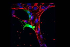 A tumor cell (green) pushes halfway through a blood vessel (red).