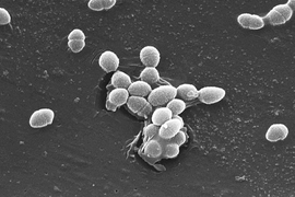 The bacterium, Enterococcus faecalis, which lives in the human gut, is just one microbe type that will be studied as part of NIH's Human Microbiome Project
