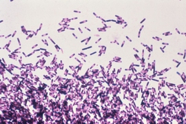 Clostridium difficile (shown here) is a bacteria in the intestines that has been successfully treated through microbiome manipulation.