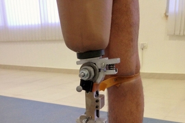 A prototype of the prosthetic knee mechanism was tested at a Jaipur Foot organization in India. 