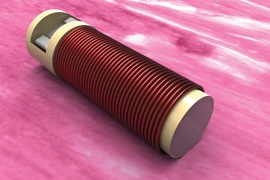 Illustration of a tiny new biochemical sensor from MIT engineers that can be implanted in cancerous tissue during an initial biopsy.